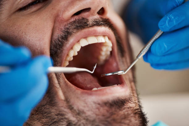 Best Urgent Dental Care for Toothaches in Morristown, IN