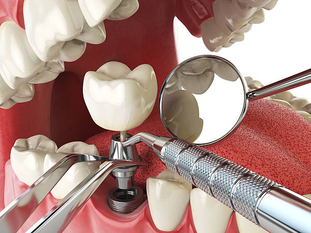 Best Emergency Treatment for Oral Infections in Morristown, IN